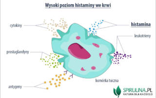 Wysoki poziom histaminy we krwi