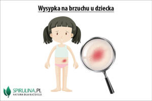 Wysypka na brzuchu u dziecka