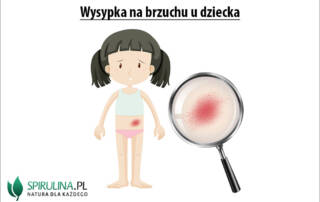 Wysypka na brzuchu u dziecka