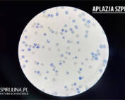 Aplazja szpiku