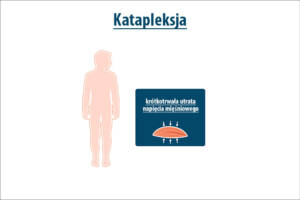 Katapleksja