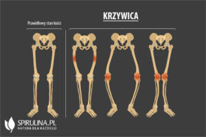 Krzywica