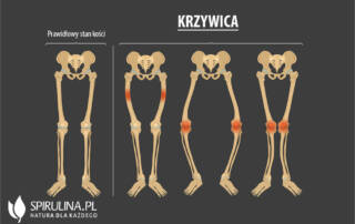 Krzywica