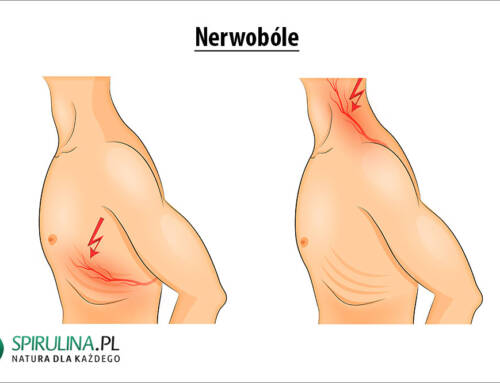 Nerwobóle