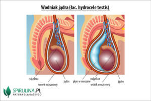 Wodniak jądra