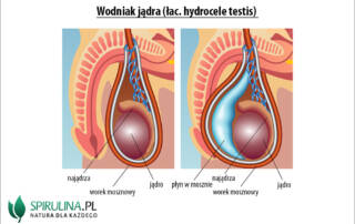 Wodniak jądra