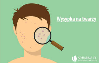 Wysypka na twarzy