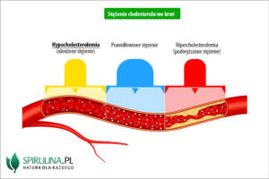 Hypocholesterolemia