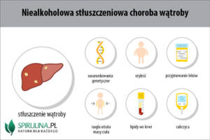 Niealkoholowa stłuszczeniowa choroba wątroby