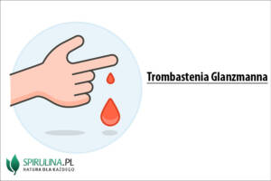 Trombastenia Glanzmanna