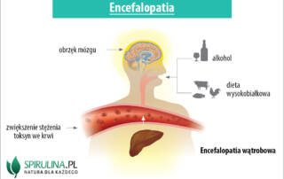 Encefalopatia