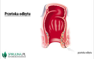 Przetoka odbytu