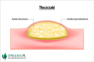 Tłuszczaki