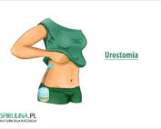 Urostomia