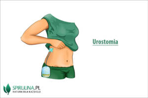 Urostomia