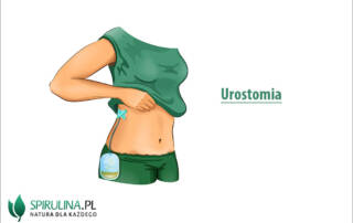 Urostomia