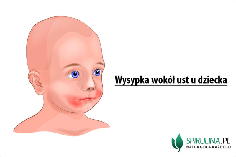 Wyciek śliny Z Kącika Ust Wysypka wokół ust u dziecka - algi Spirulina i Chlorella