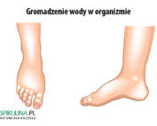 Gromadzenie wody w organizmie