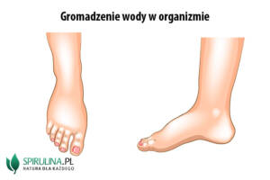 Gromadzenie wody w organizmie