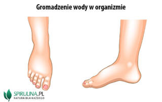 Gromadzenie wody w organizmie