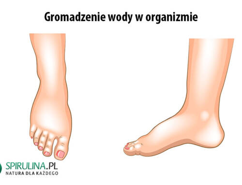 Gromadzenie wody w organizmie
