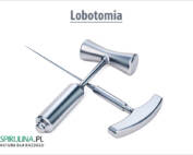 Lobotomia