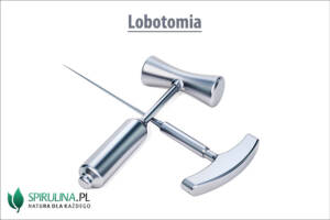 Lobotomia