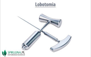 Lobotomia