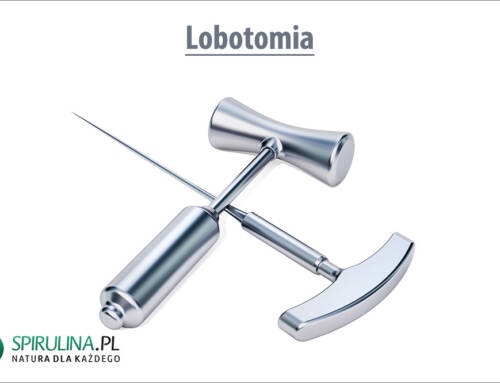 Lobotomia