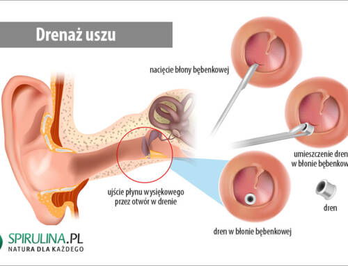 Drenaż uszu
