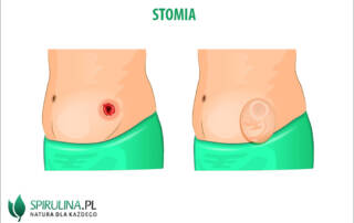 Stomia