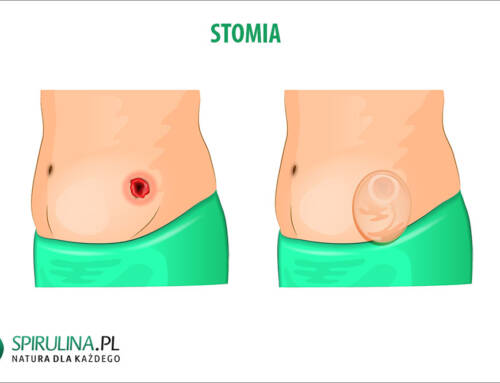 Stomia