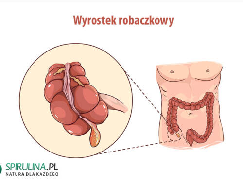 Wyrostek robaczkowy