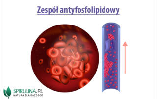 Zespół antyfosfolipidowy