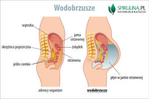 Wodobrzusze