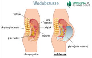 Wodobrzusze