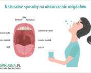 Naturalne sposoby na obkurczenie migdałów