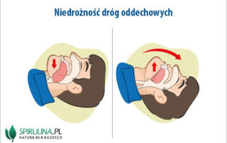 Niedrożność dróg oddechowych