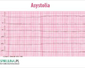 Asystolia