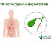 Pierwotne zapalenie dróg żółciowych