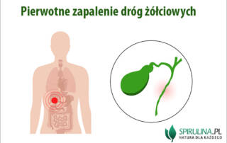 Pierwotne zapalenie dróg żółciowych