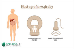 Elastografia wątroby