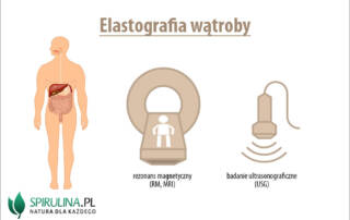 Elastografia wątroby