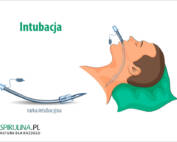 Intubacja