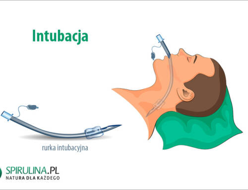 Intubacja
