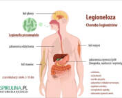 Legionella pneumophila