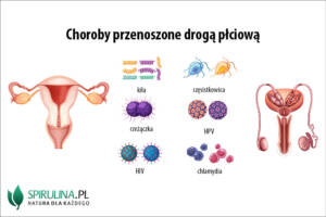 Choroby przenoszone drogą płciową