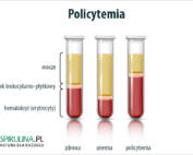 Policytemia