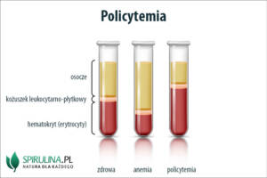 Policytemia