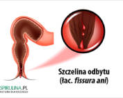 Szczelina odbytu